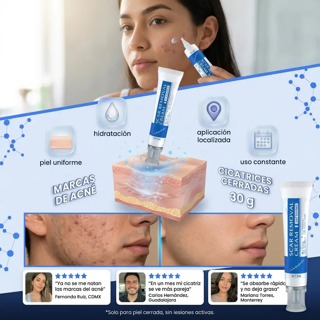 Crema Regeneradora Piel Sin Huellas – Borra Cicatrices y Marcas de Acné + Gel Exfoliante Purificante + EBOOK DE REGALO 📕